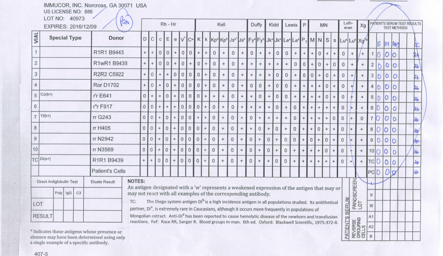 My Opinion: Use Gamma-Heavy-Chain-Specific AHG Reagent – Dr. Zeyd Merenkov