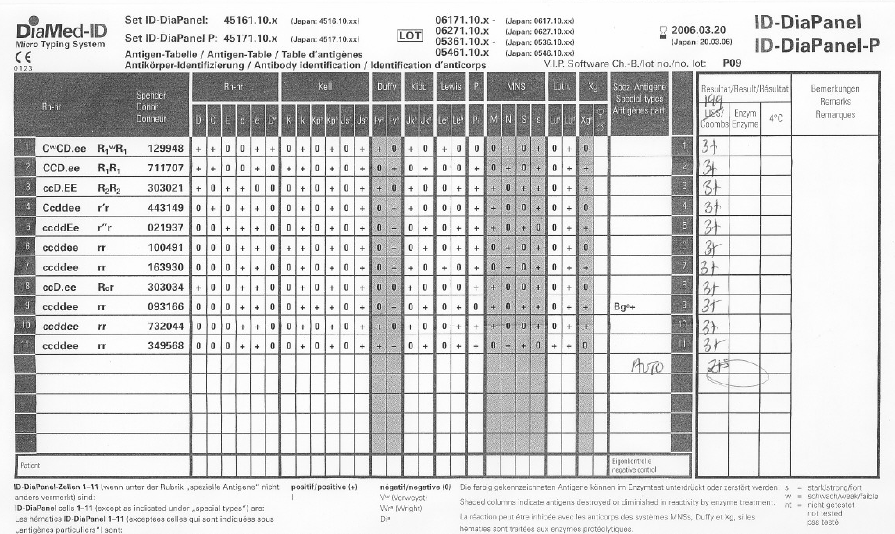 Serial Panels’ Reactivity: A Fresh Specimen and New Reagents – Dr. Zeyd ...