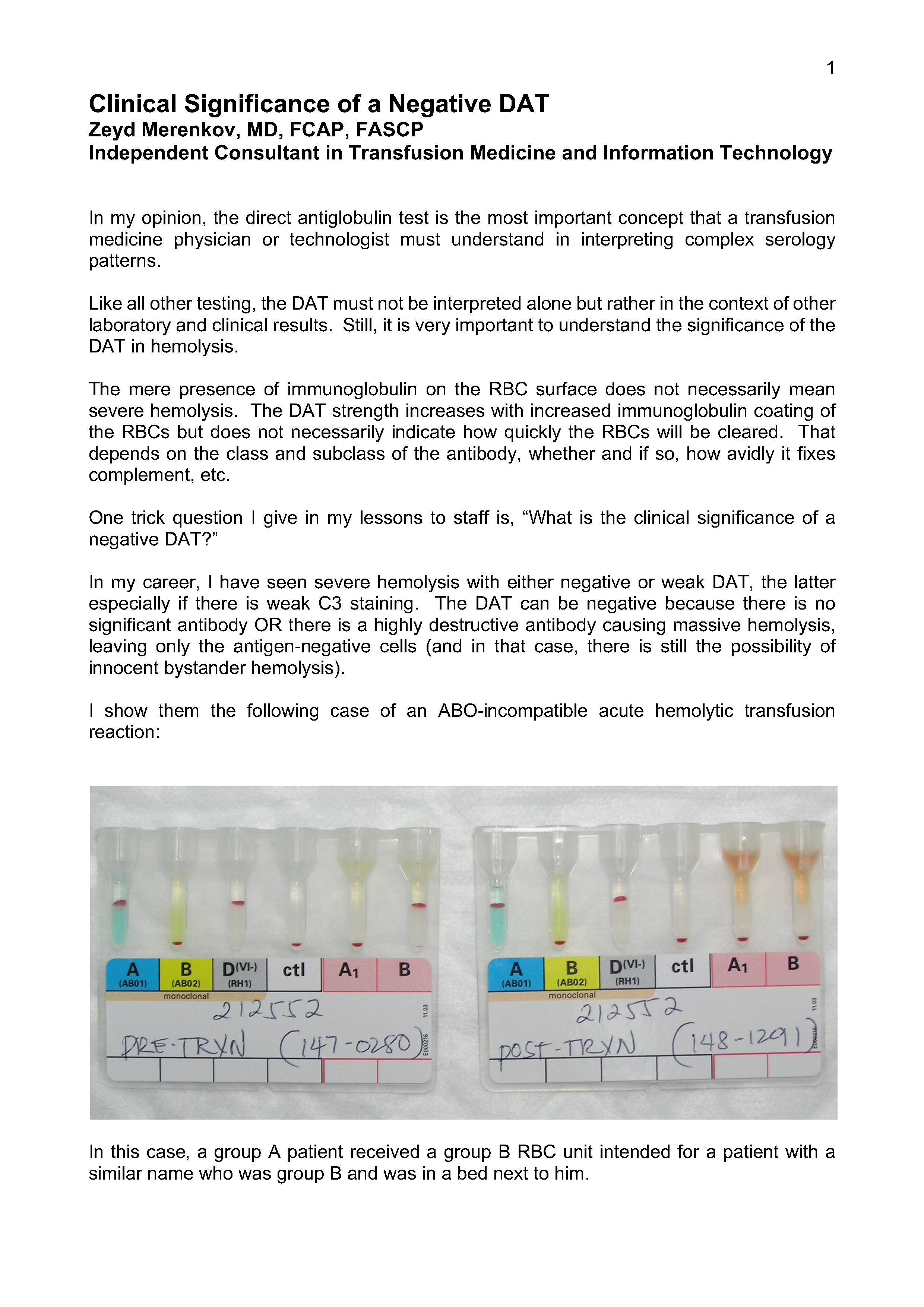 Clinical Significance of a Negative DAT – Dr. Zeyd Merenkov