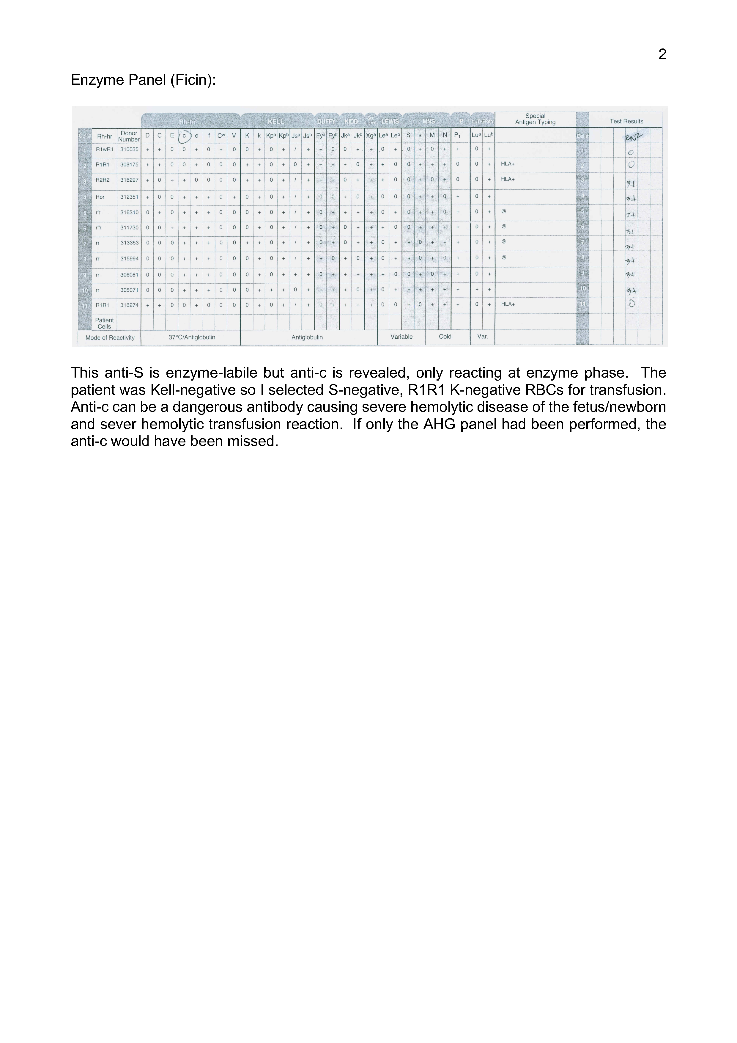 Importance of Enzyme Panels Example: Anti-S and anti-e – Dr. Zeyd Merenkov